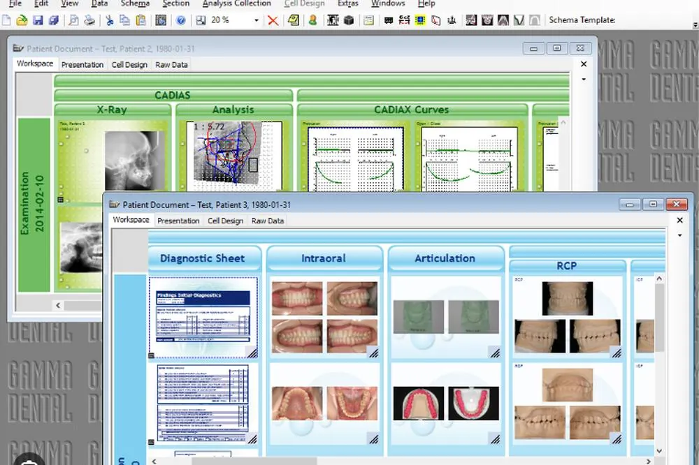 Окно GAMMA Document Browser с данными Cadiax: рентген, анализ, кривые кондилографии
